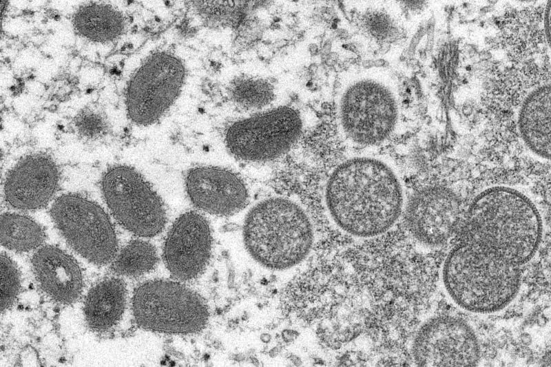 This 2003 electron microscope image made available by the Centers for Disease Control and Prevention shows mature, oval-shaped monkeypox virions, left, and spherical immature virions, right, from a sample of human skin associated with '03 outbreak.